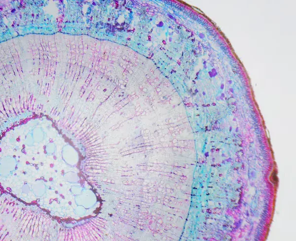 microscopic-photography-stem-xylophyta-dicotyledon-transversal-section_56854-661