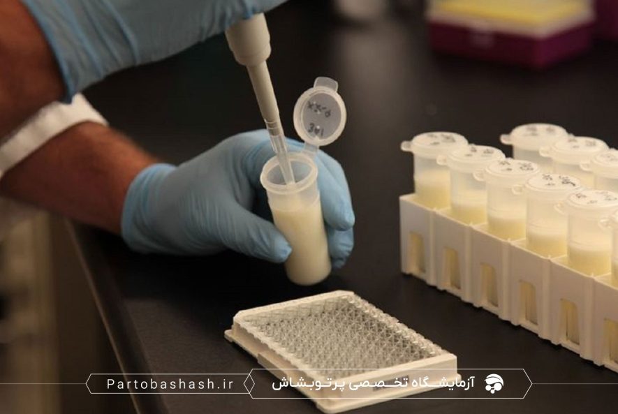 طراحی آزمون ماندگاری لبنیات با کشت میکروبی و شمارش کلونی