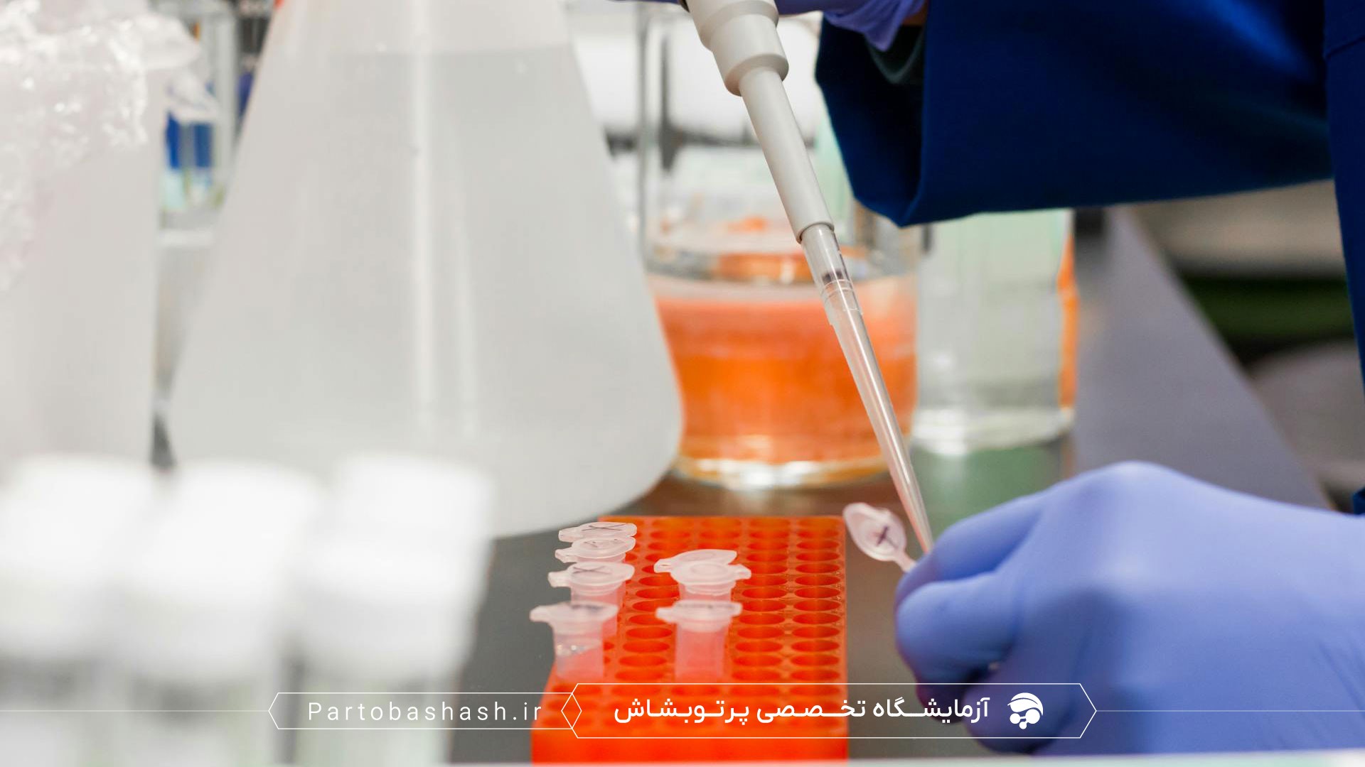 نمونهبرداری نماینده از پساب صنعتی با استفاده از استخراج DNA و qPCR